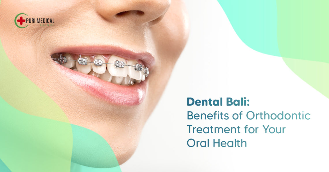 Dental Bali