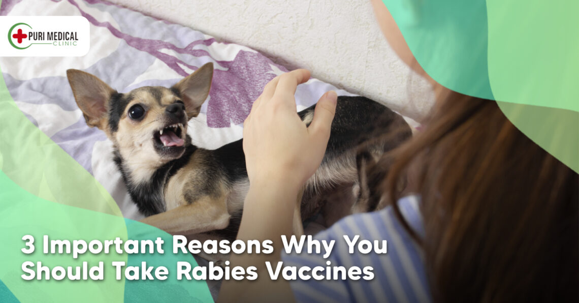 3 Important Reasons Why You Should Take Rabies Vaccine