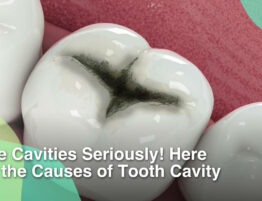 Tooth cavity develop when plaque, a sticky film of bacteria, accumulates on the surface of teeth.